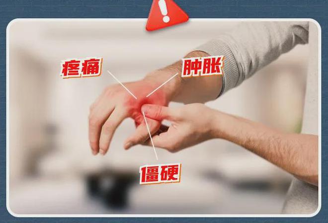 酸、手麻、腱鞘问题推荐用它！球友会平台小米生态杀疯了！手(图7)