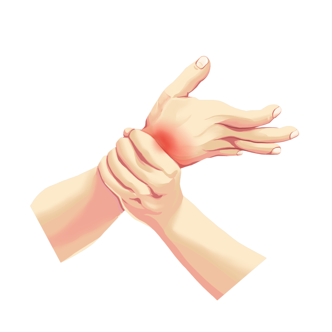 腕管综合征”找上门医生教你自测与预防阿福