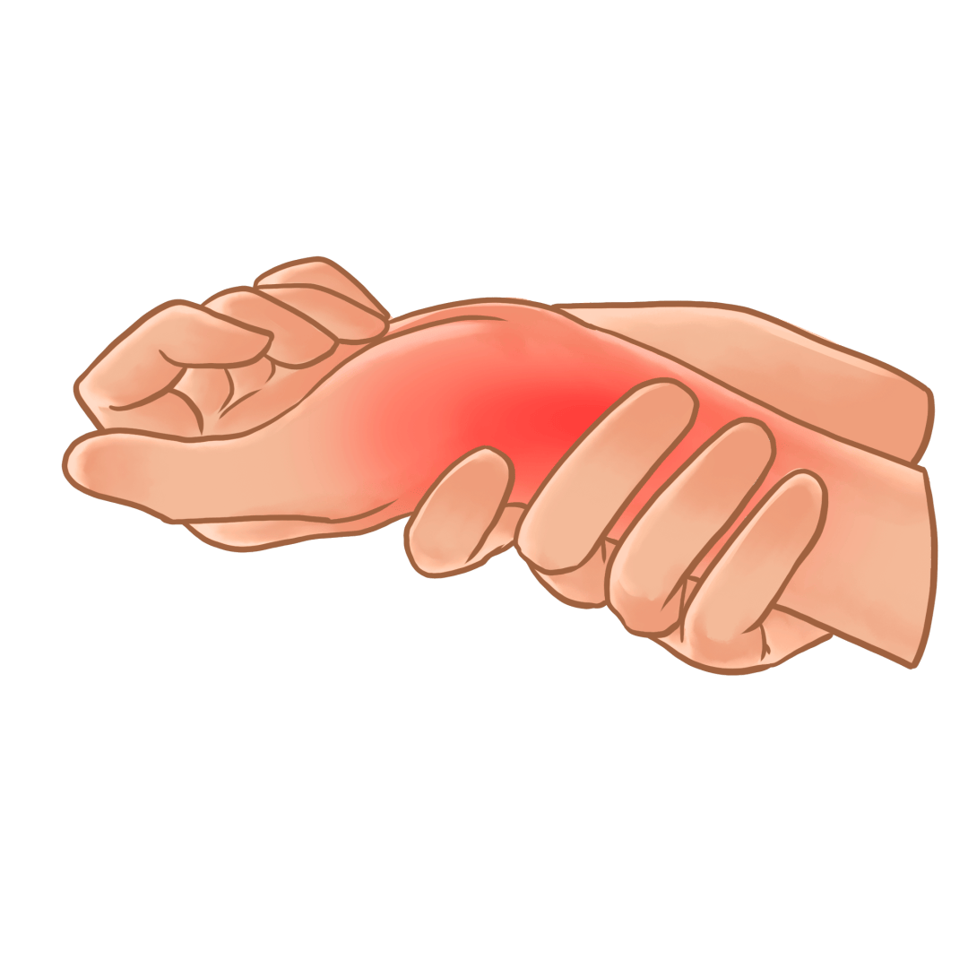 腕管综合征”找上门医生教你自测与预防阿福讲健康丨手麻手痛别忽视！可能是“(图3)